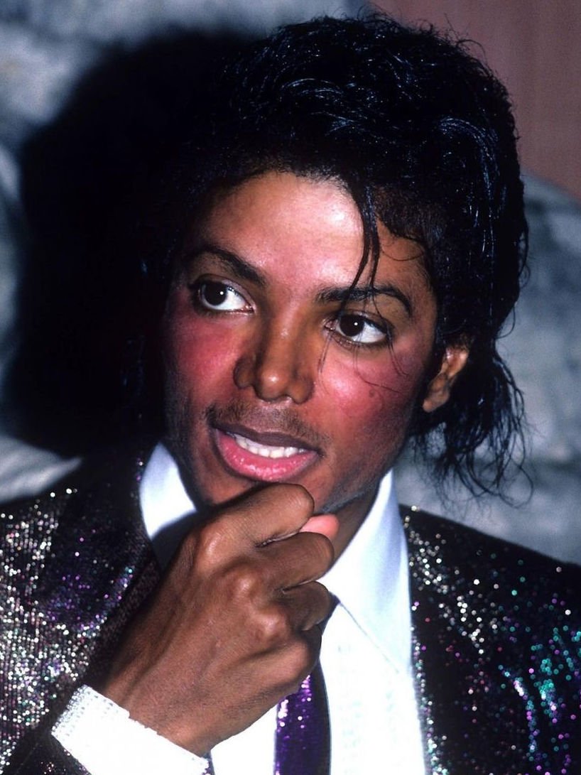 mj lupus