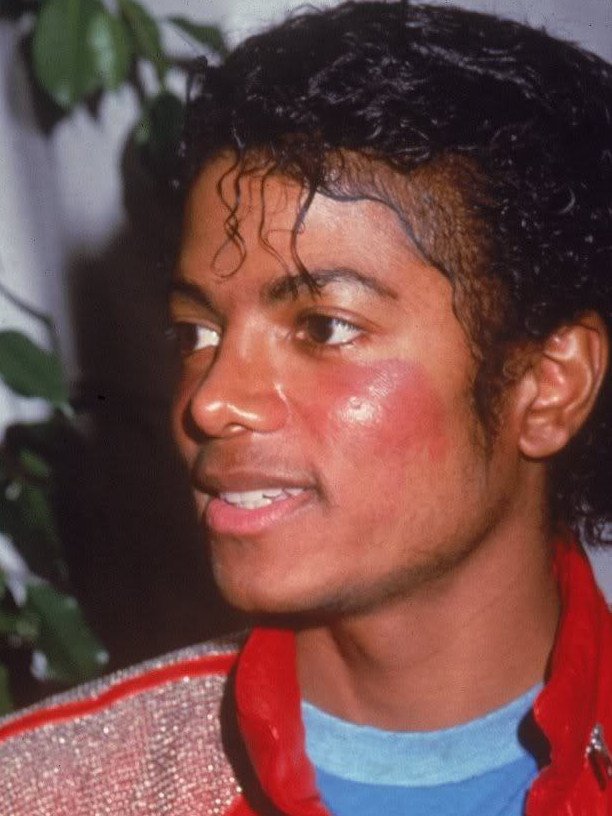 mj lupus