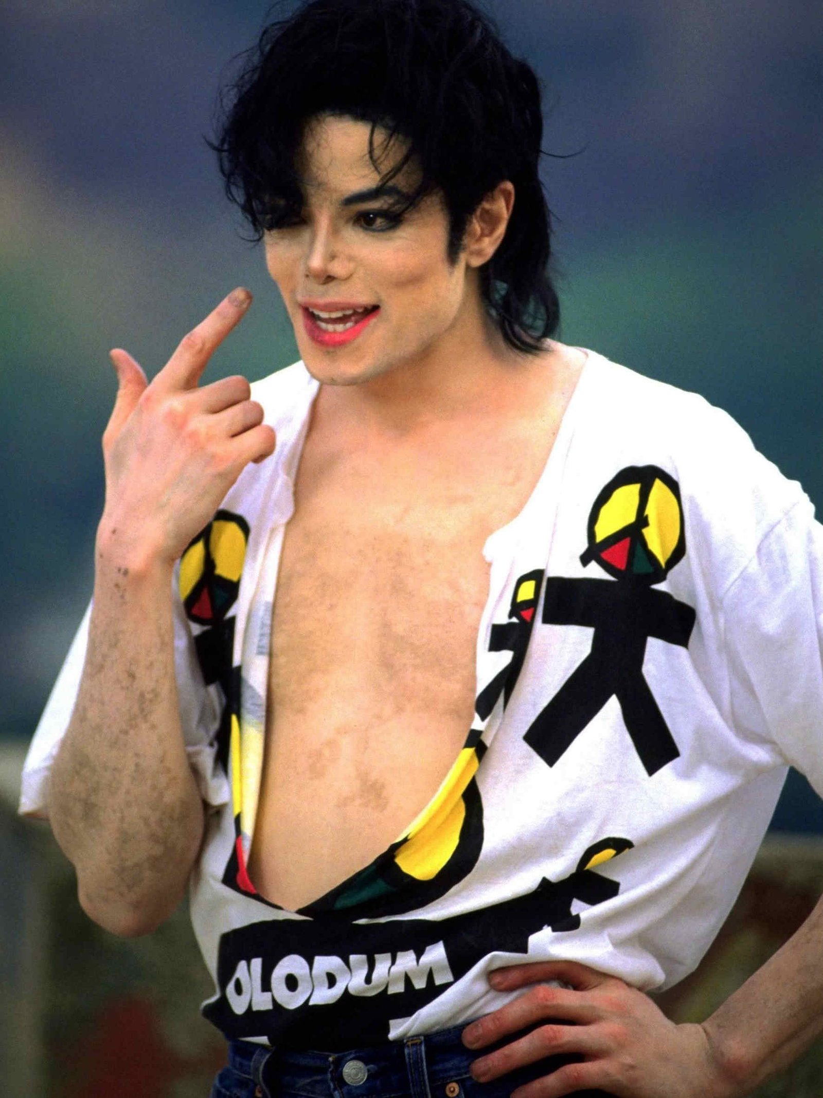 mj tdcau vitiligo 1995 imdb
