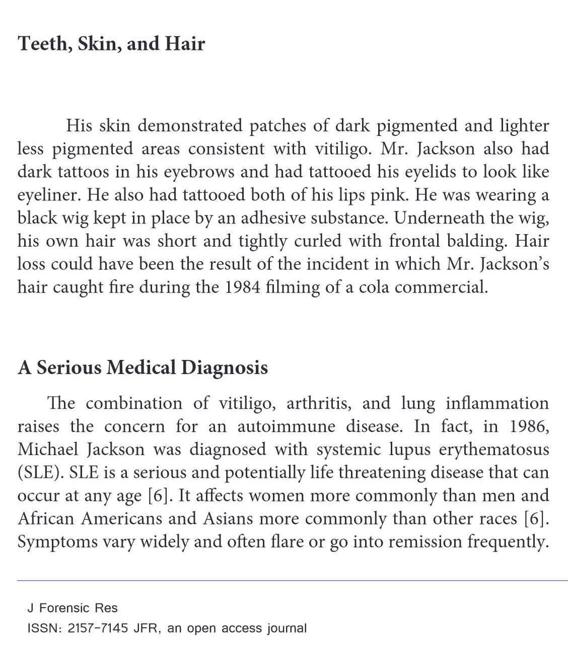 vitiligo lupus levy