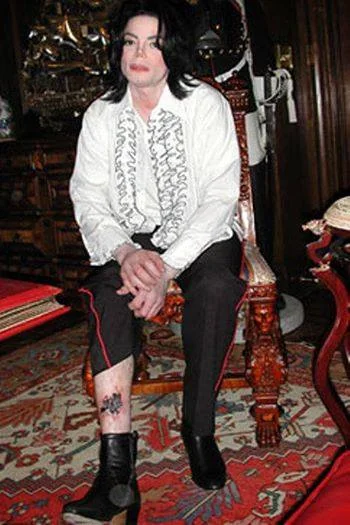 Michael Jackson spider bite 12-2002