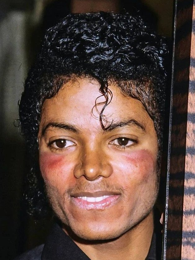 mj lupus 25.2.83