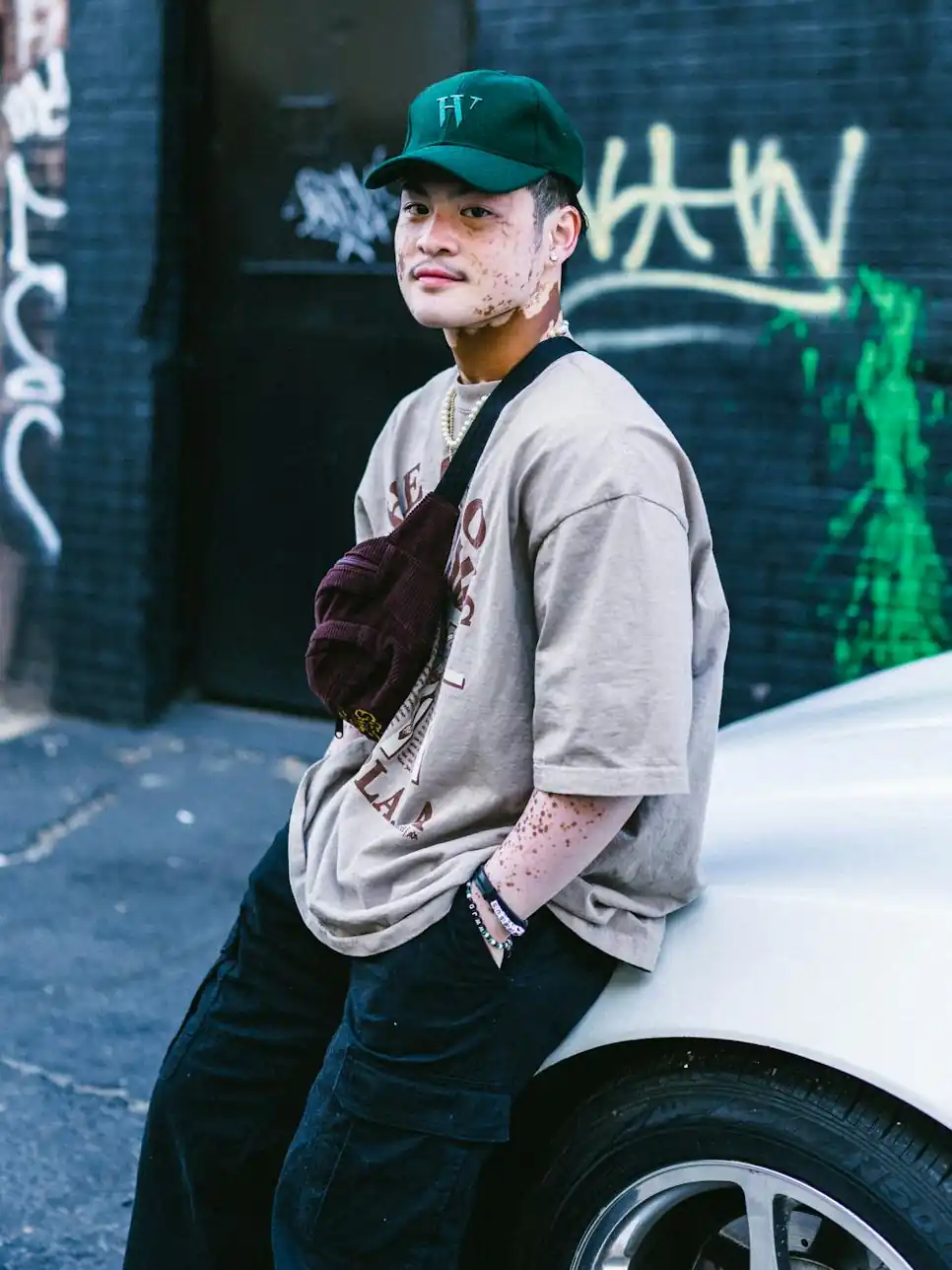 Man in a Cap Leaning Against a Car vitiligo Pexels Felix Mejica